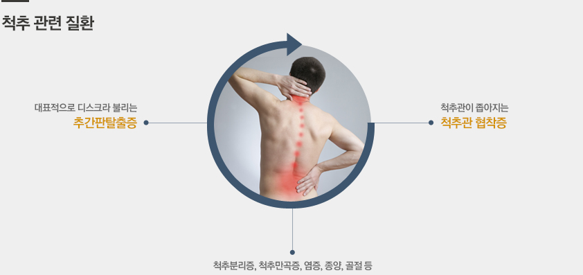 척추 관련 질환 :  추간판탈출증 척추관 협착증